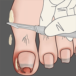 修脚高手模拟器-沉浸式修脚解压-修脚高手模拟器-沉浸式修脚解压v1.0安卓版APP下载