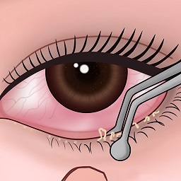 瞧瞧这眼力-清洁解压-瞧瞧这眼力-清洁解压v1.0安卓版APP下载