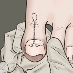 修脚恶搞模拟器-真实修脚模拟-修脚恶搞模拟器-真实修脚模拟v1.0安卓版APP下载