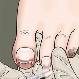 修脚师傅模拟器-休闲治愈收纳解压-修脚师傅模拟器-休闲治愈收纳解压v1.0安卓版APP下载