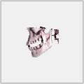 DCTViewer (CBCT查看器) v2.0.5