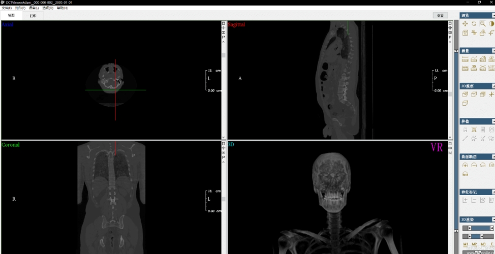 DCTViewer (CBCT查看器) v2.0.5-DCTViewer (CBCT查看器) v2.0.5免费下载