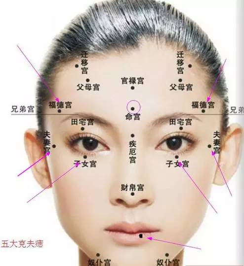 面部痣好坏一览表